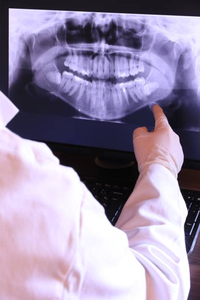 Emergency Dental Filling Replacement in MO